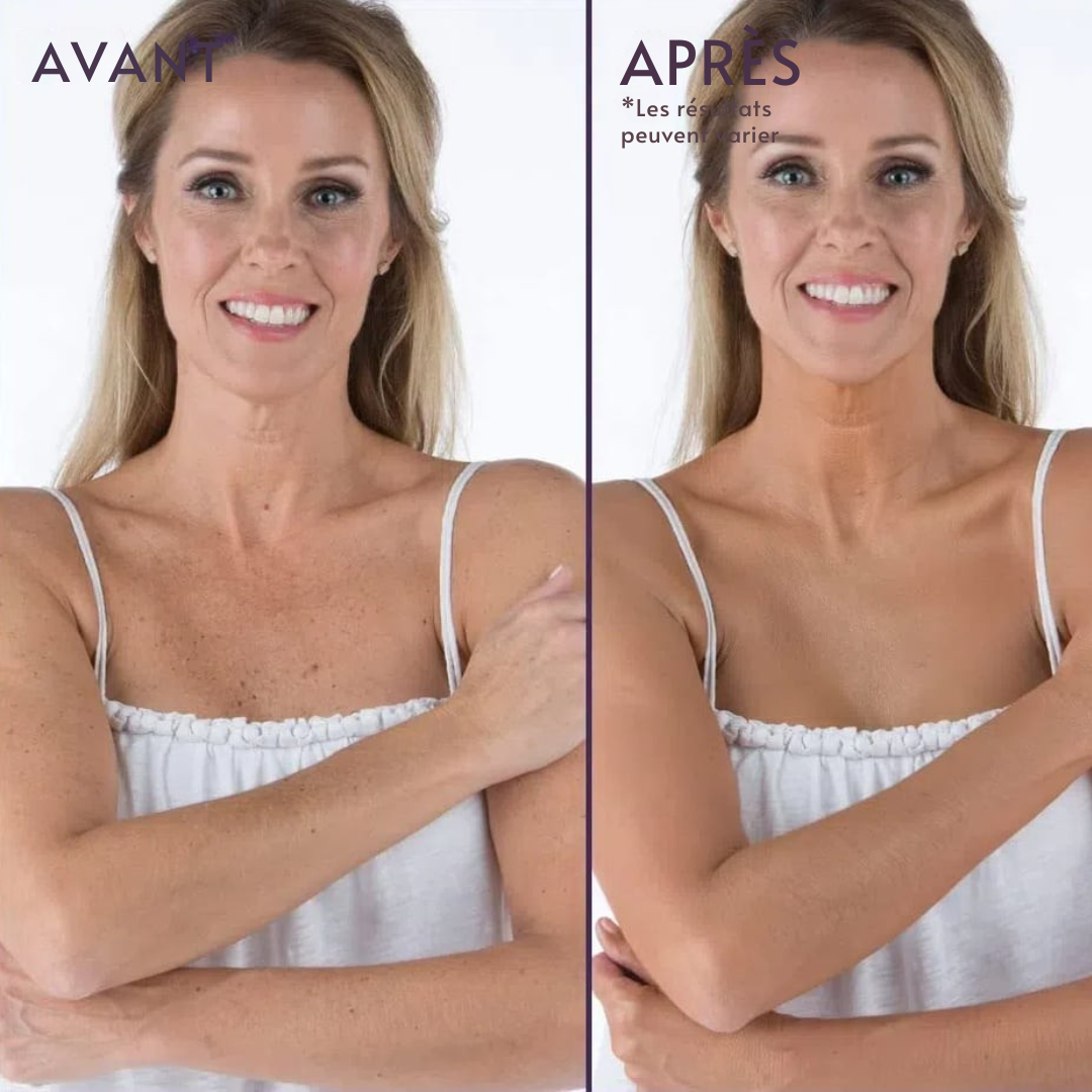 Morokos | Summer Beauty Coverage